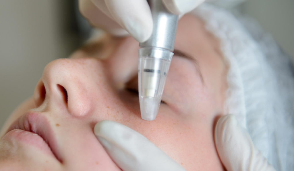 Best Microdermabrasion Machines Spotlight